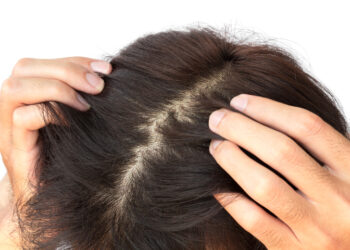 5 Signs That Your Hair Needs Regrowth Treatment