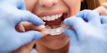 An Invasilign Dentist