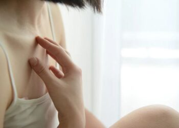 How to Heal from Eczema Scars