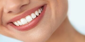 Show Off Those Pearly Whites! 5 Must-Know Tips for a Bright, White Smile