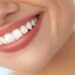 Show Off Those Pearly Whites! 5 Must-Know Tips for a Bright, White Smile