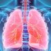 Can a CT scan Detect Lung Cancer?