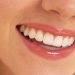 6 Reasons Why People Want Cosmetics In Their Teeth