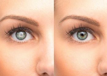 CAUSES OF DEVELOPING EYE CATARACTS