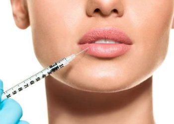 Lip Fillers: Everything You Need to Know