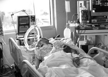 How a Medically Induced Coma Can Help After a Brain Injury