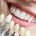 The Benefits of Dental Implants Explained