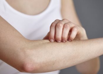 What is Hydrocortisone and the Dangers of Steroid Cream