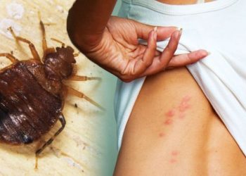 What causes bed bug infestations? 