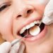 Dental Cleaning Costs And Why They Are Essential