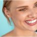 4 Things You Didn’t Know About Lingual Braces