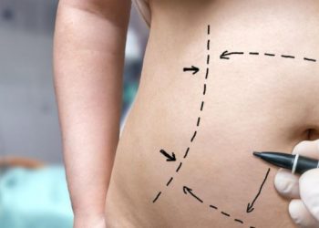 A Guide to the Different Types of Surgery for Weight Loss