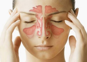 When to See a Sinus Doctor for Sinusitis Treatment?
