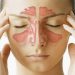 When to See a Sinus Doctor for Sinusitis Treatment?
