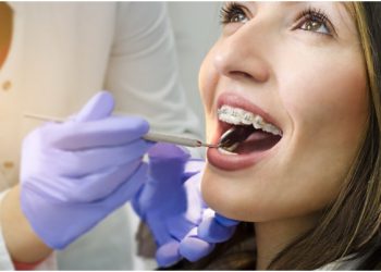 How Do I Choose the Best Orthodontist in My Local Area?