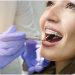 How Do I Choose the Best Orthodontist in My Local Area?