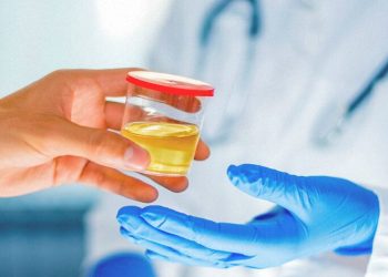 Causes Of Diluted Urine In A Drug Test