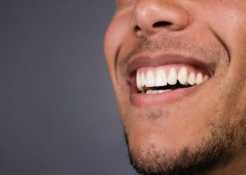 3 Common Dental Veneer Mistakes and How to Avoid Them