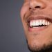 3 Common Dental Veneer Mistakes and How to Avoid Them