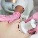 Does ultrasonic cavitation work