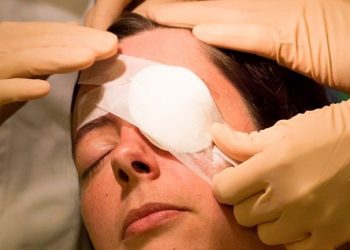 How to Help Someone After Cataract Surgery