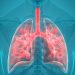 How to Keep Your Lungs Healthy and Fit?