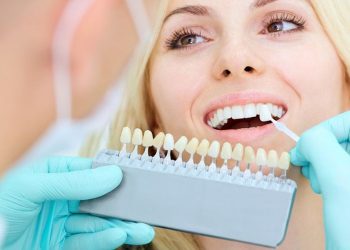 Why should you prefer porcelain veneers? 