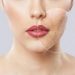 Acne Care – 6 Formulations Dermatologists Recommend to Fight Acne