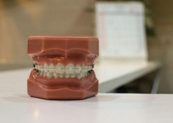 Difference Between Orthodontist and Dentist 