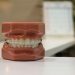 Difference Between Orthodontist and Dentist 
