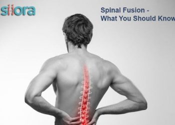 Spinal Fusion – What You Should Know