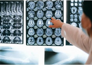 How Can Online Neurologists Help With Memory Loss?