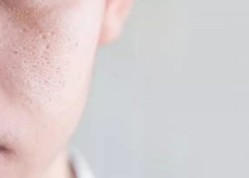 How to make skin blemishes less visible.