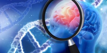 What You Should Know About Alzheimer’s