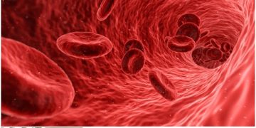 How To Deal With Spider Veins The Right Way