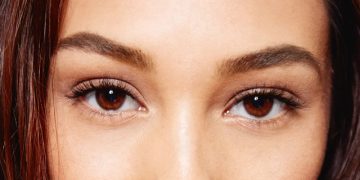 Can botox be used under the eyes?