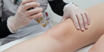 The Pros and Cons of Laser Hair Removal
