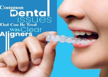 Common Dental Issues That Can Be Treat With Clear Aligners