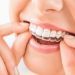 Why Should You Consider Using Invisalign?