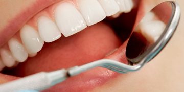 Plaque and Your Teeth: What You Need to Know