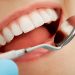 Plaque and Your Teeth: What You Need to Know