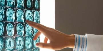 When is a Medical Malpractice Lawsuit Necessary