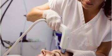 Look Younger Without Surgery With Liftera V Lift Technology