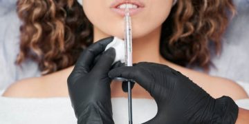 Fillers Make Your Lips Look Significantly Better