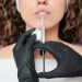 Fillers Make Your Lips Look Significantly Better