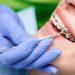 Braces and Beyond: Exploring Your Options for Orthodontic Treatment in Surrey