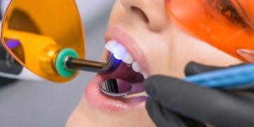 Unlocking the Power of Cosmetic Dentistry: Transforming Your Smile Beyond Teeth Whitening