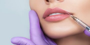 Lip Fillers 101: A Comprehensive Guide to San Diego Services