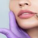 Lip Fillers 101: A Comprehensive Guide to San Diego Services