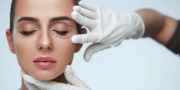 Exploring the Benefits of Double Eyelid Surgery